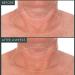 R Vive Neck Firming Cream - Overnight Moisturizer for Wrinkles Tightens & Brightens Neck & D colletage (75ml) - International Shipping Available - Buy Online on GoSupps.com