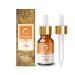 Crysalis Benzoin Pure Essential Oil (Styrax Benzoin) Steam Distilled Essential Oil - 30 ml (1.01 Fl Oz) Benzoin 30.00 ml (Pack of 1)