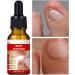  TQEBWUS Nail and Toenail Strengthening Liquid - 10ml Ingrown Toenail Corrector Drops Beauty Care for Hands and Feet Nighttime Travel Treatment for Dry Damaged Cracked Curved Fragile and Chipped Nails - Buy Online on GoSupps.com