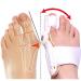 Unisex Bunion Corrector Toe Thumb Valgus Correction Belt - Day & Night Support (White) - Aoyuexi - Buy Online on GoSupps.com