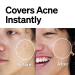 FRONTMAN Fade Skin-Colored Acne Cream for Men - L1 Light Shade 0.33oz - Buy Online on GoSupps.com