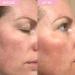SKINICIAN Revitalising Toner - Hydrating Toner for Brighter Looking Skin - Facial Toner with Soothing Cucumber & Vitamin B5 - Revitalise Skin - Spray Mist Toner - Vegan & Cruelty Free (200ml) - Buy Online on GoSupps.com