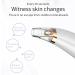 Pore Vacuum Blackhead Remover with 3 Suction Probes & Hairband - Facial Pore Cleaner for Acne, Blackheads & Whiteheads (White) - Buy Online on GoSupps.com