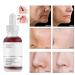 Peeling Solution 30ML | AHA 30% + BHA 2% Anti Acne Serum | Exfoliating Facial Serum for Pore Congestion & Fine Lines | 1 PCS - Buy Online on GoSupps.com