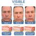 DERMA+ Firm Peptide Eye Gel Set for Men | Anti-Aging & Depuffing | 2023 New Formula | Moisturizing Cream | 3PCS Pack - Buy Online on GoSupps.com