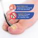 Extra Strength Toenail Fungus Treatment - 1% Tolnaftate for Discolored Nails & Athlete's Foot (30ml) - Fast-Acting OTC Formula - Buy Online on GoSupps.com