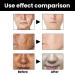 Melanin Correcting Facial Serum - Dark Spot Corrector for Anti-Aging Glow | 2PCS Daily Face Serum for Men and Women - Buy Online on GoSupps.com