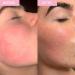 SKINICIAN Revitalising Repair Mask - Hydrating Facial Beauty Mask - Calms & Restores Radiance - Soothing Cream Face Mask with Shea Butter - Vegan & Cruelty Free Skincare (50ml) - Buy Online on GoSupps.com