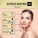 Professional 70% Glycolic Acid Peel for Youthful Glow and Skin Revitalization - Erase Wrinkles, Boost Collagen, Shrink Pores, and Fade Acne Scars at Home - Buy Online on GoSupps.com