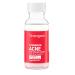Neutrogena Stubborn Acne Spot Drying Lotion - Fragrance-Free 10% Sulfur Acne Treatment Paraben & Oil-Free 1 fl. oz - Clears & Shrinks Pimples - Buy Online on GoSupps.com