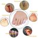 10-Piece Breathable Gel Toe Protector | Pain Relief for Corns, Blisters, Ingrown Toenails | Women & Men - Buy Online on GoSupps.com