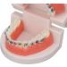 Buy Typodont & Demonstration Tooth Model | Educational Dental Training Tools for Labs - Buy Online on GoSupps.com