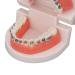 ANGGREK Dental Typodontic Tooth Model with Orthodontic Metal Mount | Ideal for Teaching & Research - International Shipping Available - Buy Online on GoSupps.com