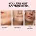Niacinamide Pure Serum Pore Reducer Face Serum Niacinamide Serum Shrinking Enlarged Pores Serums Skincare Brightening Serum Face Serum For Women Balancing Sebum Production 15ml - Buy Online on GoSupps.com