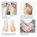 YUYTE Hallux Valgus Corrector - Bunion Orthotics for Women Men - Toe Separator & Alignment Orthopedic Brace [S] - Buy Online on GoSupps.com