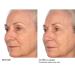 NassifMD Pro Peptide Collagen Serum | Anti-Aging Treatment for Fine Lines Wrinkles & Textured Skin - Firm & Smooth Your Skin - Buy Online on GoSupps.com