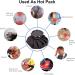 Ice Bag for Injuries & Pain Relief - 4 Pack 6 inch Reusable Cold Pack with Screw Top Lid - Buy Online on GoSupps.com