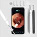Ear Wax Removal Ear Wax Removal kit Ear Wax Removal Tool Camera 1080P Hd Endoscope  Wireless Ear Cleaner Tools with 6 Led Lights Waterproof Ear Scope Compatible with iPhone & Android Phones  (White)