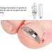 Ingrown Toenail Tool Effective Correction Wearable Stainless Steel Clip Buckle Relieve Pain Stainless Steel - Buy Online on GoSupps.com