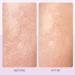 First Aid Beauty KP Bump Eraser Body Scrub - 10% AHA Exfoliating Skin Cleanser for Keratosis Pilaris Strawberry Scent 2 oz - International Shipping Available - Buy Online on GoSupps.com