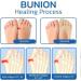 Projoint AntiBunions Health Socks - Orthopedic Toe Compression Socks for Women - Urigone Five Finger No Show Socks (10 Skin) - Buy Online on GoSupps.com