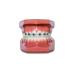 Snapcaps Paw Print 10 Ct: Bracket Cover Bumper for Braces - Orthodontic Accessories - Buy Online on GoSupps.com