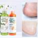 Foot Peeling Spray Orange Oil Foot Peeling Spray That Remove Dead Skin Tea Tree Foot Peeling Spray Remove Dead Skin within Seconds Exfoliator For Cracked Rough Heels Dry Toe Skin&Calluses (2Pcs) Orange+Green - Buy Online on GoSupps.com