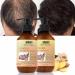 MKKENLEY Ginger Anti Hair Loss Shampoo & Conditioner Set - Hair Growth Treatment for Men & Women - Nourishes Scalp, Promotes Hair Regrowth - 300ml - Buy Online on GoSupps.com