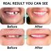 Fluktrix Cosmetic Teeth Veneers - Temporary Comfortable Smile Enhancers for Upper & Lower Teeth - 2 Pairs - Buy Online on GoSupps.com