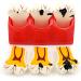Buy Samnuerly 4-Fold Dental Teeth Caries Model - Removable Tooth Pathology & Evolutionary Display for Dental Training | International Shipping Available - Buy Online on GoSupps.com