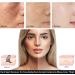 Go Ho 2PCS Dark Spot Remover - Vitamin C Cream for Face Body & More | Effective Blench Lotion & Dark Spots Corrector - Buy Online on GoSupps.com
