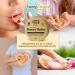 Shop Manuka Honey Hemp Ointment for Neurodermatitis & Eczema | Dermatologically Recommended | Heals Dry Cracked Skin - Hemp Help Store - Buy Online on GoSupps.com