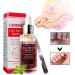 Beito 1PC Nail Repairs Solution de renouvellement des ongles l'huile essentielle tue les ongles fongiques Traitement fongique pour ongles cassants et craquel s (12ML) - Buy Online on GoSupps.com
