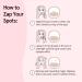Grace & Stella Pimple Patches for Face - 72 Hydrocolloid Acne Patches | Vegan & Cruelty-Free Blemish Stickers Dermatologist Tested - Buy Online on GoSupps.com