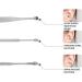 Primobe Ear Wax Cleaner Innovative Spring Earwax Cleaner Tool Set Portable Ear Wax Cleaning Kit Ear Pick Cleaner Cleaning Kits Ear Wax Removal Kit for Ear Adult (Blue-B) - Buy Online on GoSupps.com