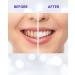 Teeth Whitening Strips - 14-Day Treatment for Sensitive Teeth | Achieve a Whiter Smile & Remove Tough Stains | Made in USA - Buy Online on GoSupps.com