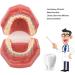 Typodont Orthodontic Tooth Model (28 Teeth) - Realistic Crowded Teeth & Malocclusion Representation for Dental Education & Practice - Buy Online on GoSupps.com