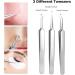Pinkiou Blackhead Removers and Pimple Extractors Kit - 8-in-1 Skincare Tool for Face and Nose - Buy Online on GoSupps.com