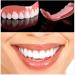 Professional Upper White Teeth Braces - 3 Piece Veneer Set for a Perfect Smile - International Shipping Available - Buy Online on GoSupps.com