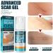 PLGEBR Fade Scar Cream Gel - Postpartum Stretch Marks & Burn Scar Treatment - Buy Online on GoSupps.com