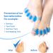 AGARES Toe Spacers (8-Piece Set) | Bunions Correction for Women & Men | Toe Brace for Foot Pain & Plantar Fasciitis - White - Buy Online on GoSupps.com