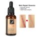 Lavender Scar Removal Serum for Stretch Marks & Skin Repair - Brightening Treatment Liquid - Buy Online on GoSupps.com