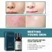Wormwood Facial Oil - 100% Natural Essential Oils Moisturizing 10 mL | Shop Internationally - Buy Online on GoSupps.com