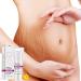 Best Stretch Mark Cream for Pregnancy & Postpartum - Repair & Remove Scars - Buy Online on GoSupps.com
