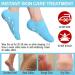 JIAHAO Moisturizing Spa Gloves and Socks for Dry Feet Thermoplastic Gel Repair to Heal Eczema Cracked Skin Calluses Cuticles Gel Lining Infused with Essential Oils Vitamins to Soften Skin - Buy Online on GoSupps.com