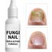 Nail Health | 15 ml Manicure and Cuticle Softener | Cuticle Softening Gel | For the treatment of damaged nails and yellow cuticles - Buy Online on GoSupps.com