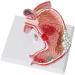 Human Stomach Lesion Model with Diaphragm Model Digestive System Model gastric Ulcer Model - Buy Online on GoSupps.com