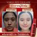 Vorda Red Therapie Serum Facial 30ml - Korean X50 Photoglow for Radiant Skin | International Shipping - Buy Online on GoSupps.com