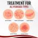 Giltpeak Kolmax Psoriasis & Vitiligo Relief Spray (3 Pcs) | Reduces Symptoms, Suitable for All Skin Types - Buy Online on GoSupps.com