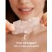 LitBear XL T-Zone Patch - 30 Patches, Hydrocolloid for Nose, Forehead, Chin, Pimple, with Tea Tree & Calendula Oil - Buy Online on GoSupps.com